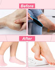 Silicon Foot Care